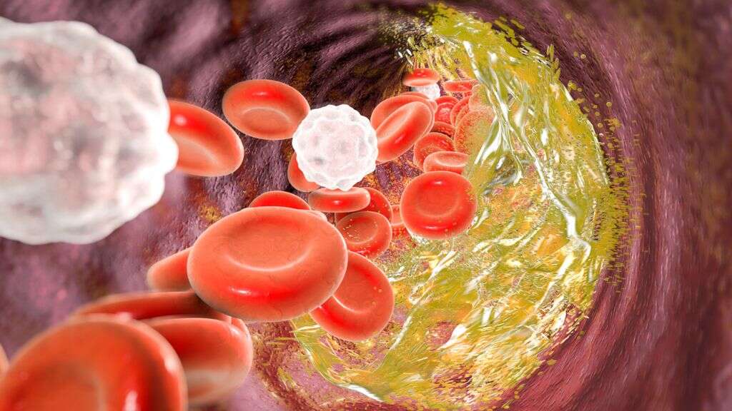 What Is Included On A Lipid Panel