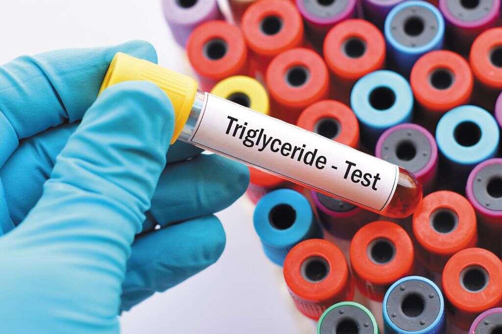 lipid-profile-test-purpose-normal-values-preparation