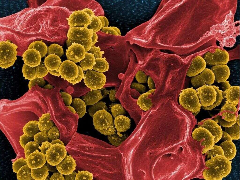 What Is a MRSA Infection?