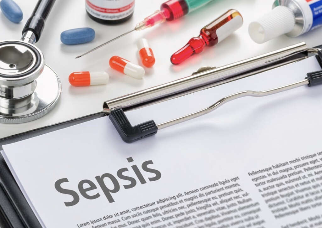 Sepsis Infection