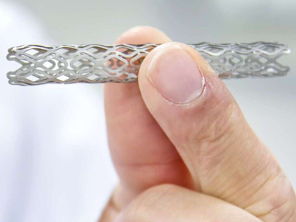 What Is a Stent?