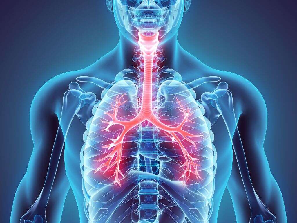 Tracheostomy