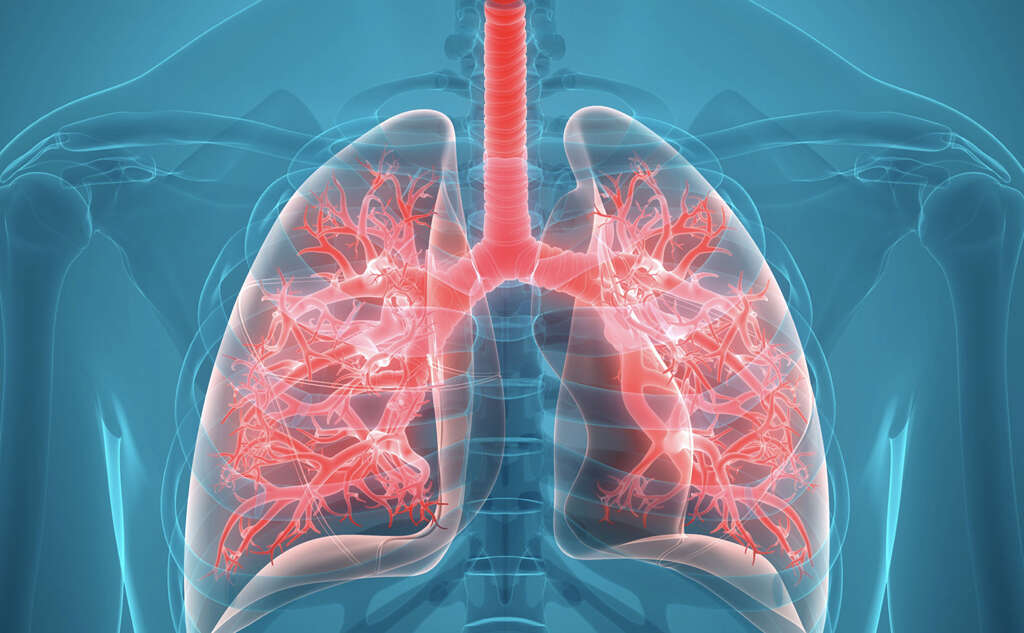 Acute Bronchitis