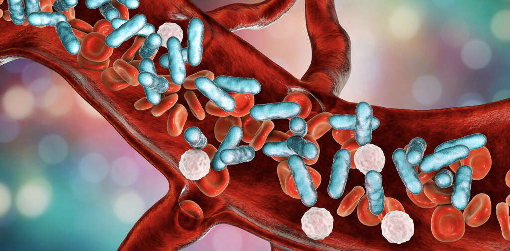 Acute Renal Failure