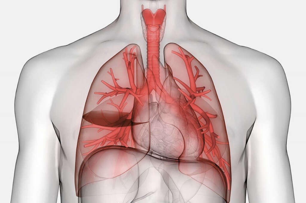 acute-respiratory-distress-syndrome-what-is-acute-respiratory-distress