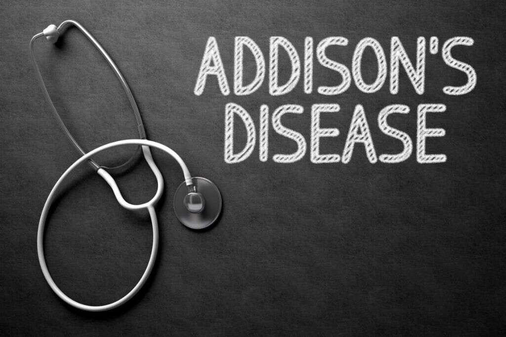 Addison's Disease