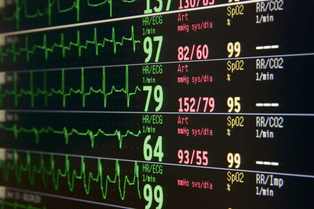 Electrocardiogram