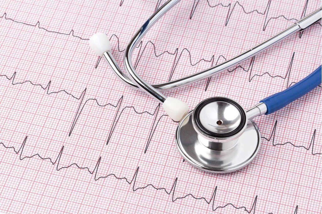 Electrocardiogram