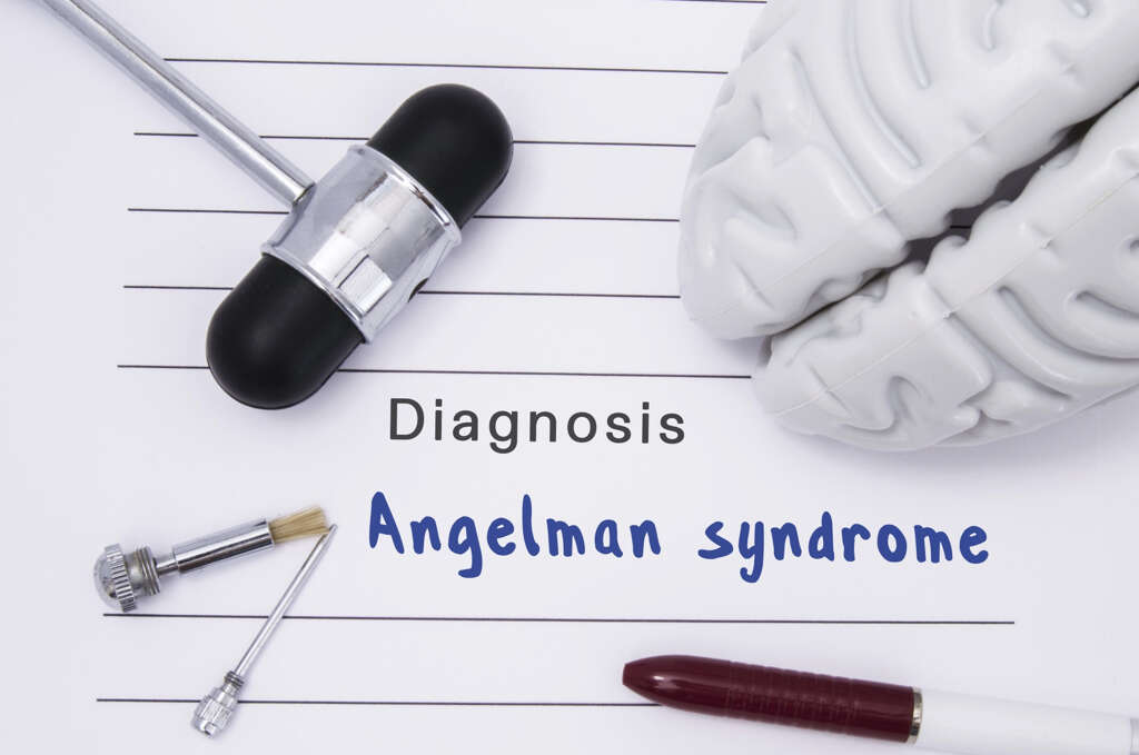 Angelman Syndrome