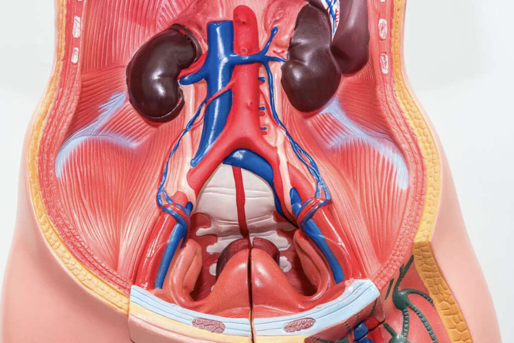 Ascites