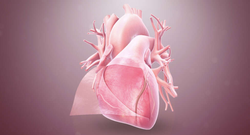 Cardiac Tamponade