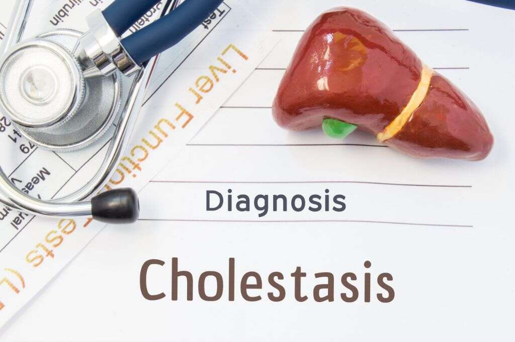 Cholestasis What Is Cholestasis?