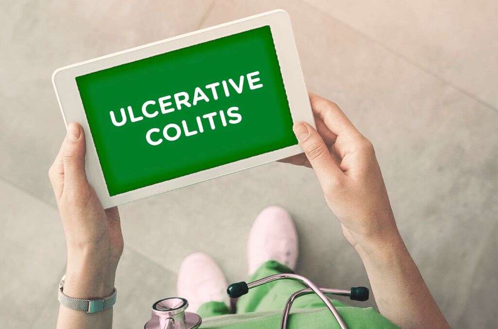 Colitis