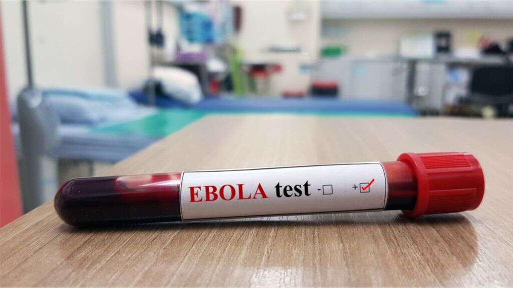 Ebola