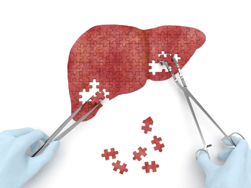 Fatty Liver Disease