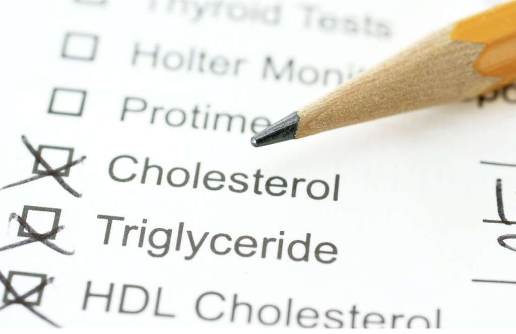 HDL Cholesterol