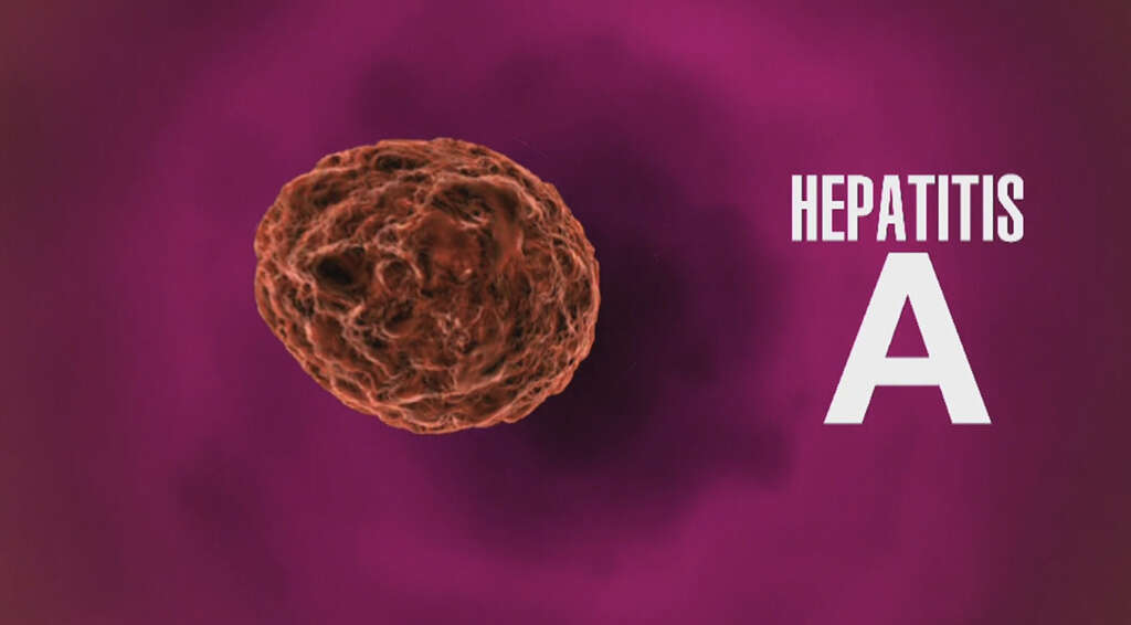 Hep A