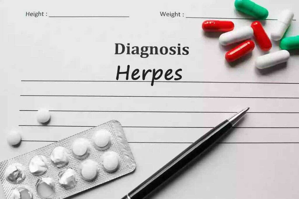 Herpes