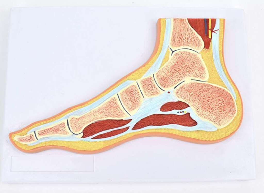 Hypermobility Syndrome