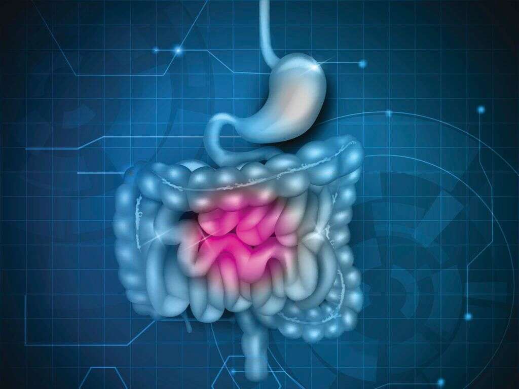 Leaky gut syndrome исследования