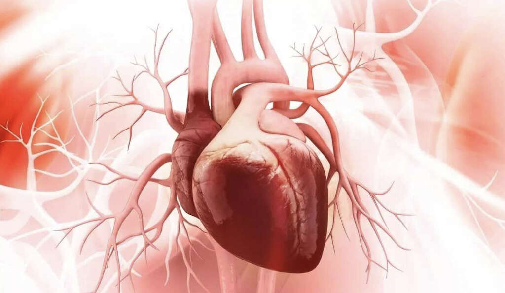 Myocarditis