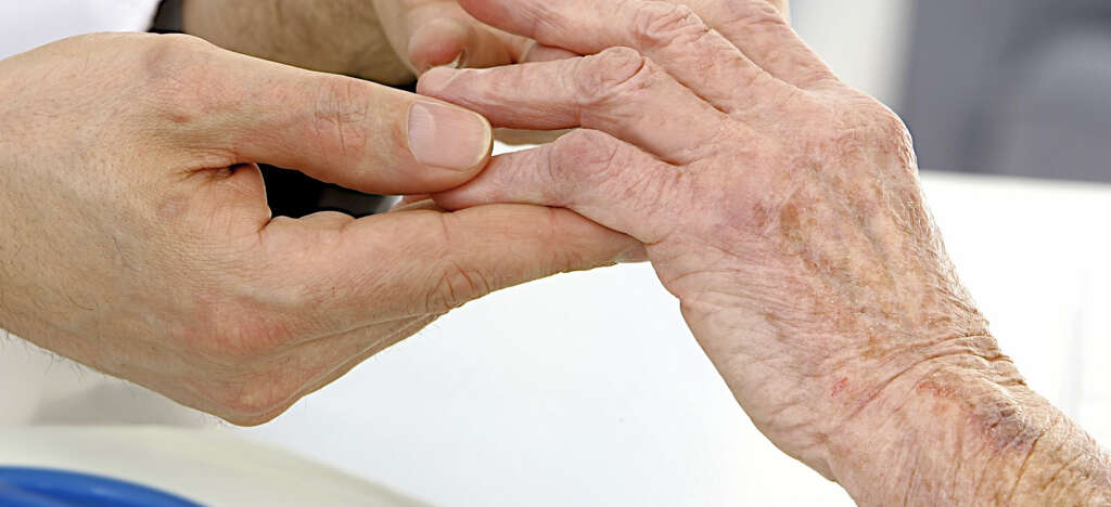 is there any treatment for raynauds disease