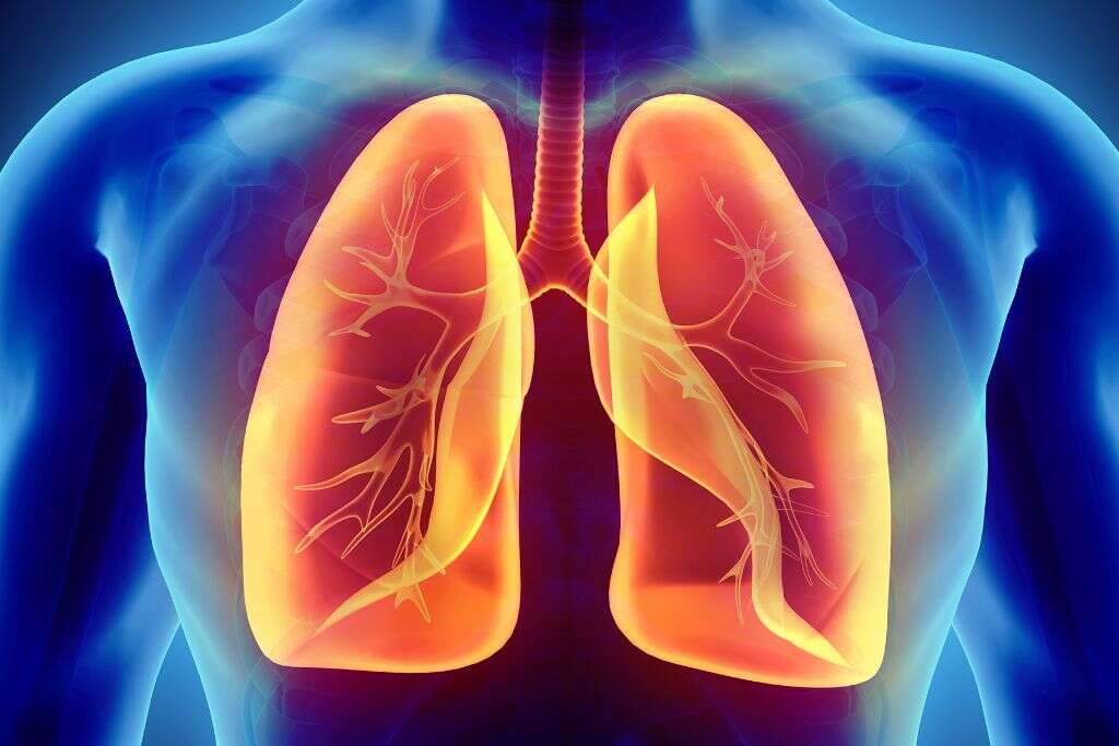 Respiratory Acidosis