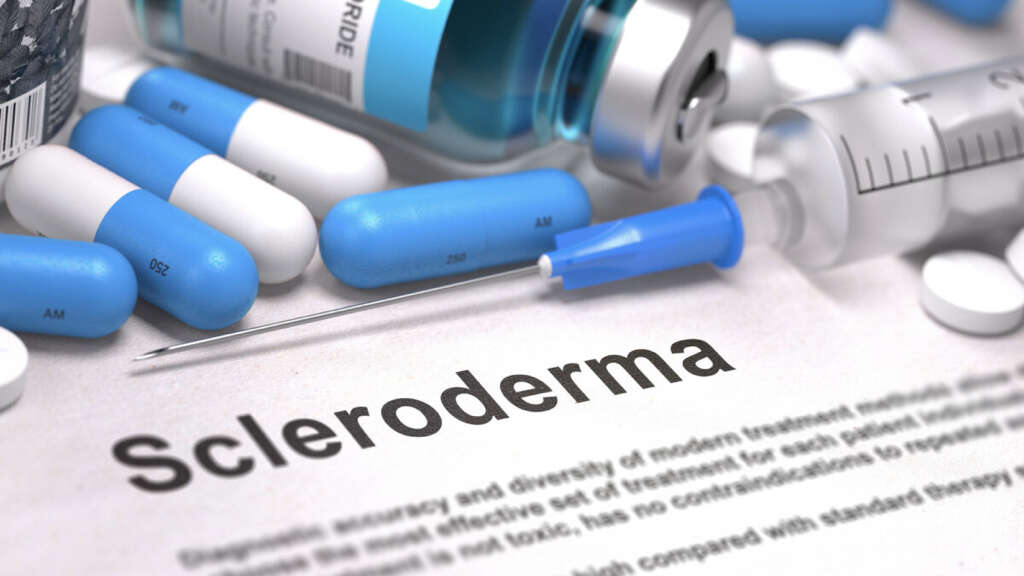 Scleroderma