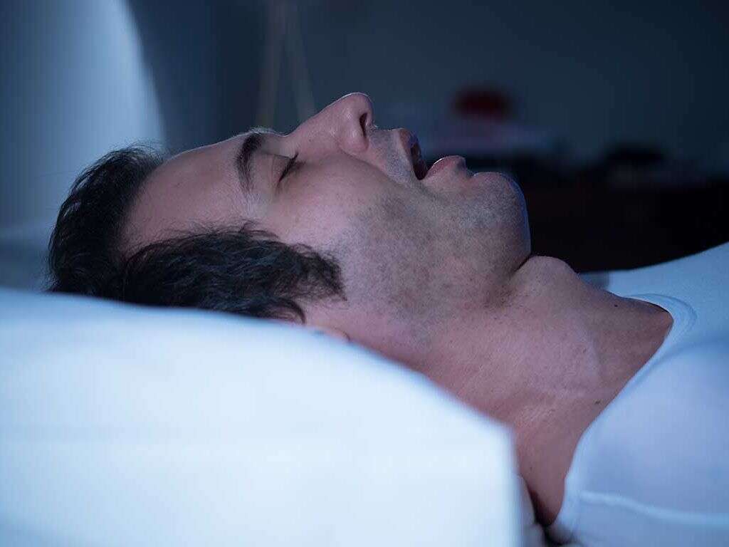 What Is Sleep Apnea?