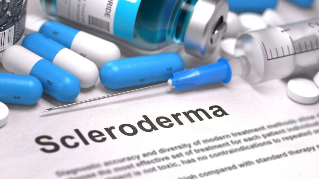 Systemic Scleroderma