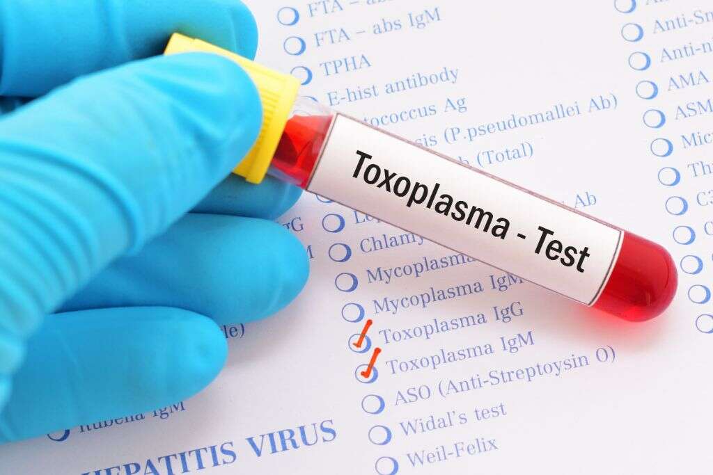 Toxoplasmosis