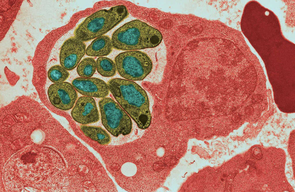 Trichinosis What Is Trichinosis